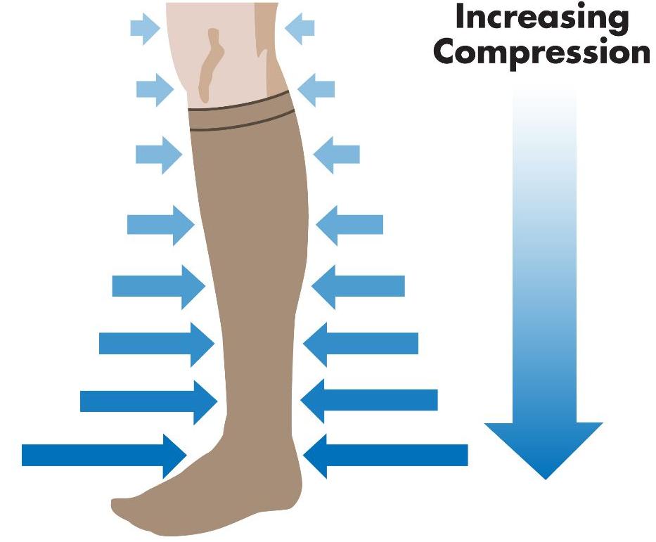 Use and application of graduated elastic compression stockings